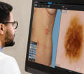 Canfield DermaGraphix®  