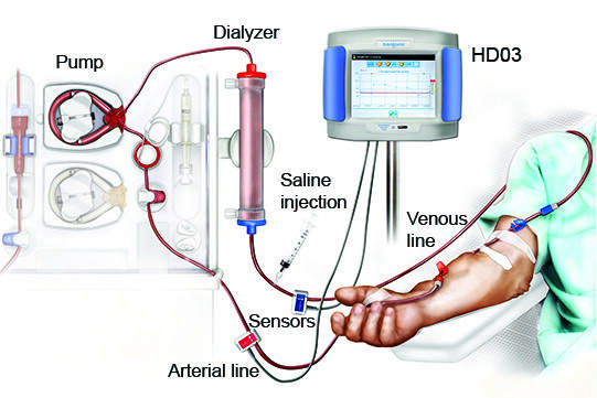 HD03 Transonic flowmåler 