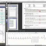 RTSoft Ultima til RTest 4 Software uden AF option